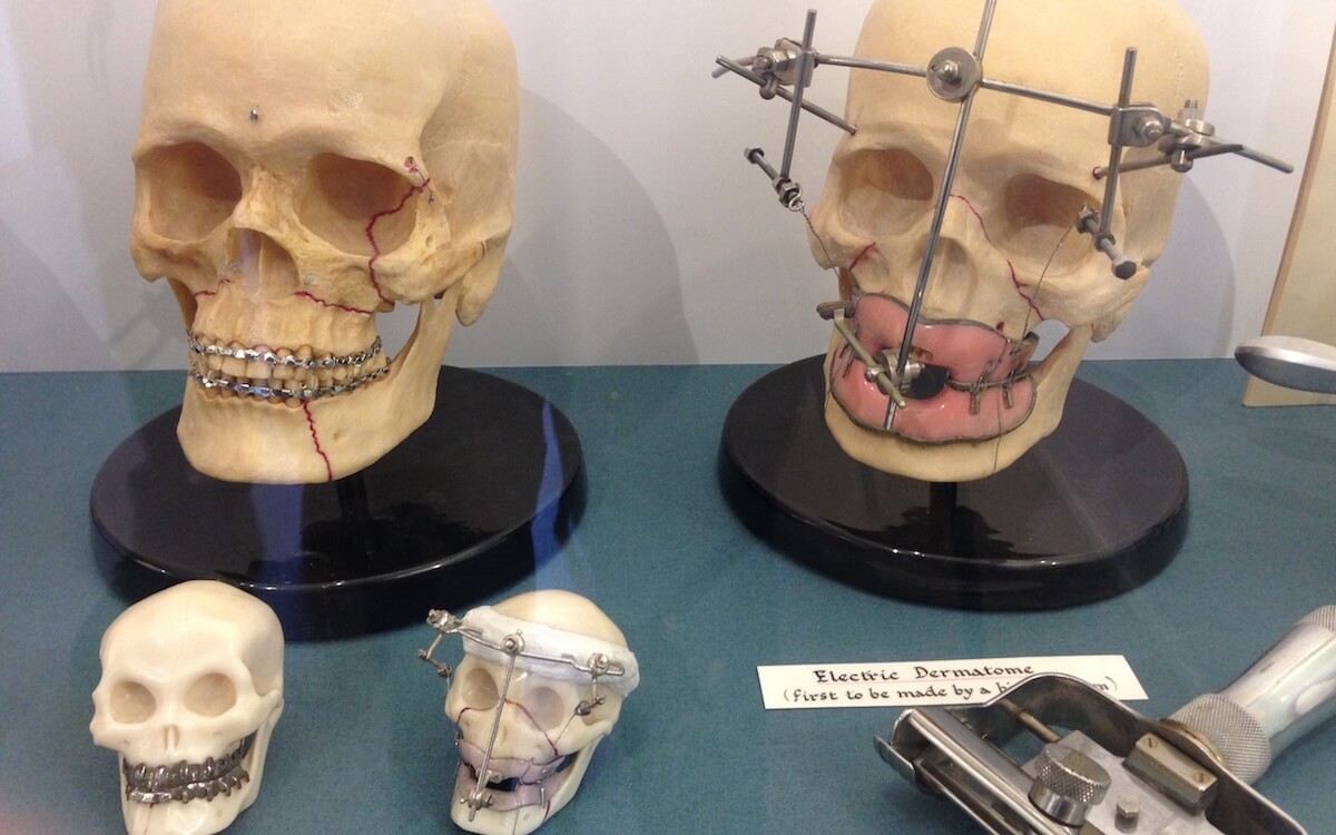 Artificial skulls at the East Grinstead Museum